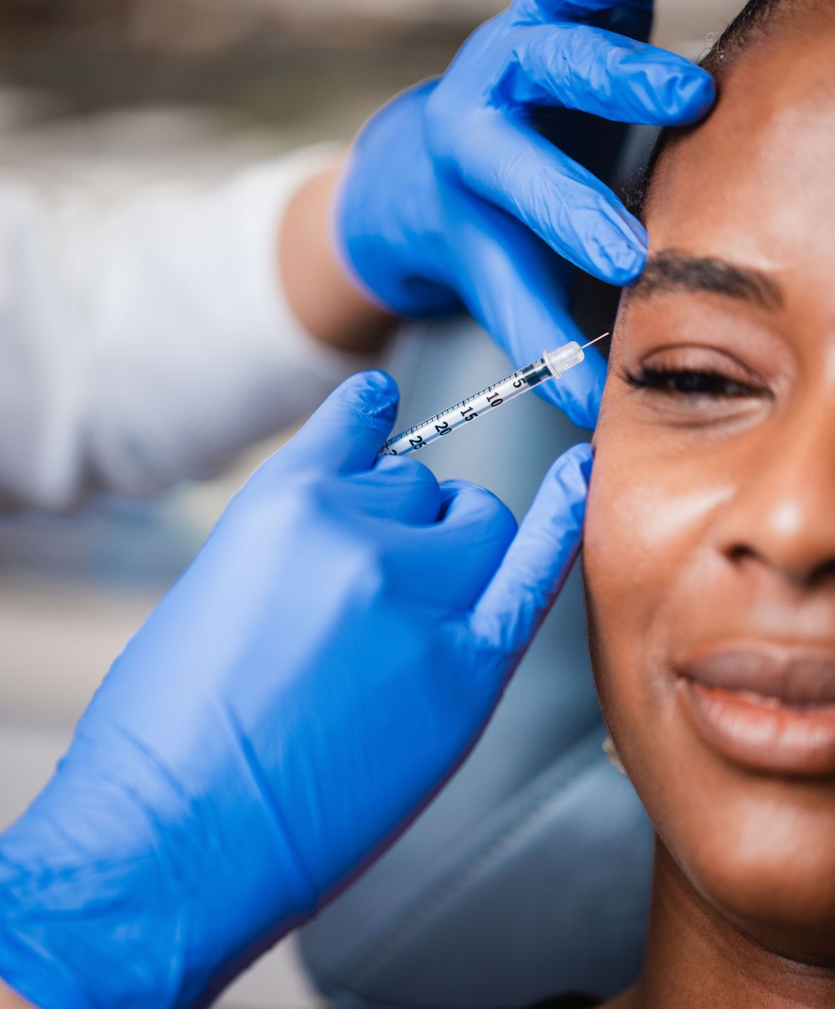 Restylane Refyne feature image