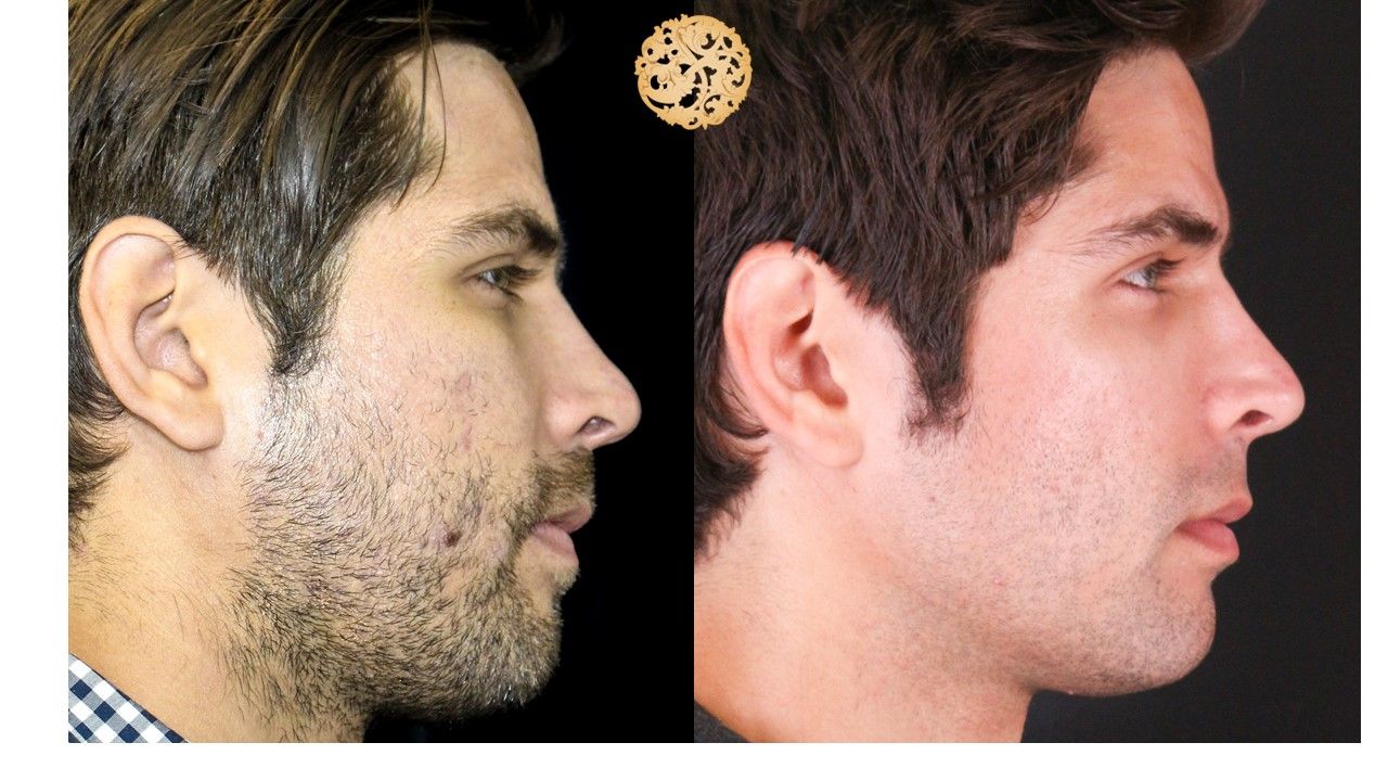 Vivace Before & After