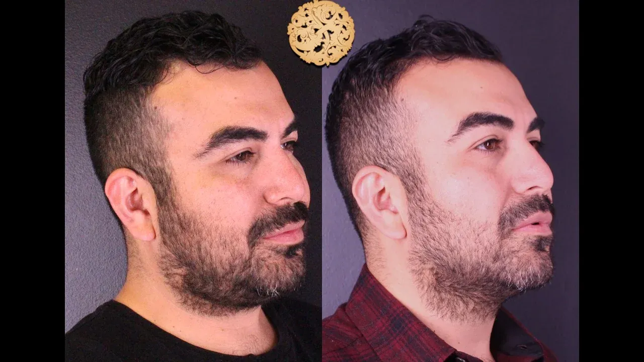 Vivace Before & After