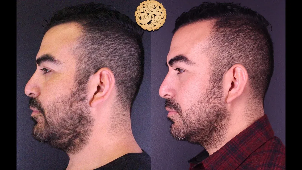 Vivace Before & After