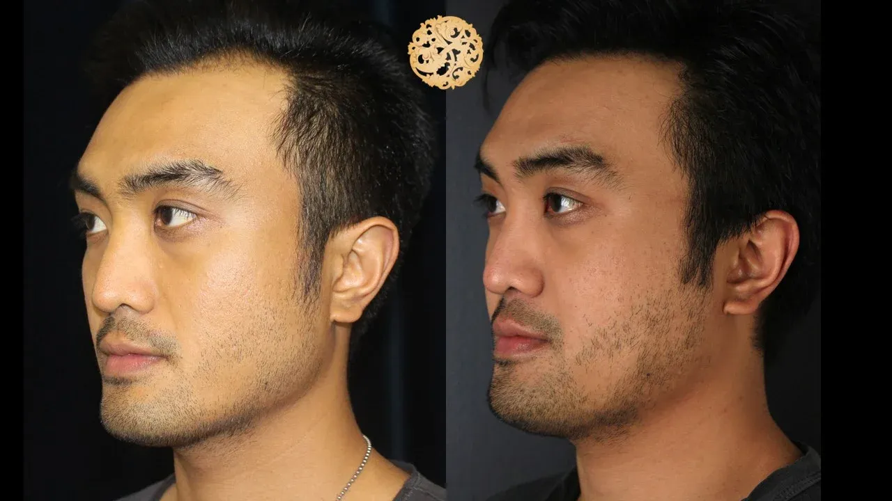 Vivace Before & After