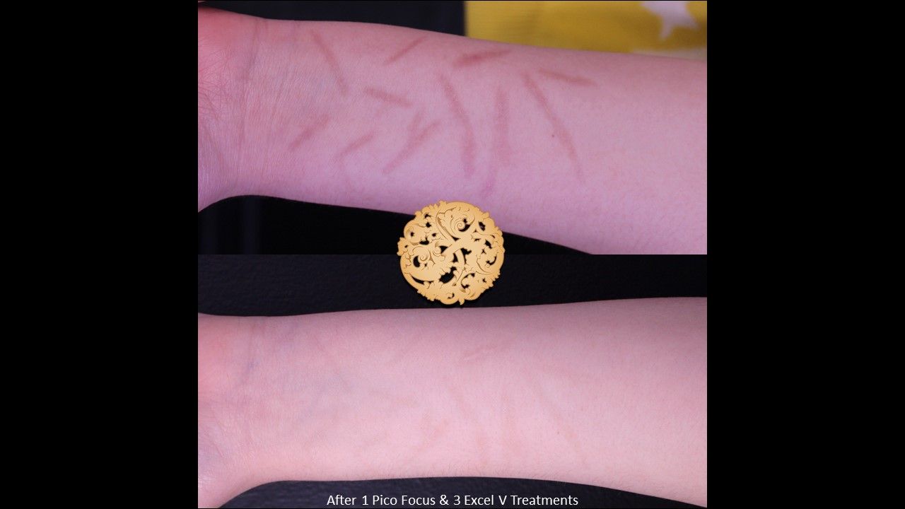 Excel V Before & After