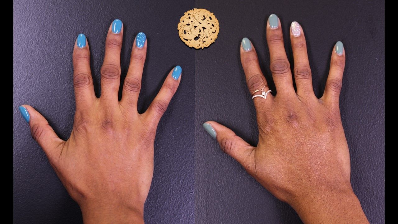 Fat Transfer Hands Before & After