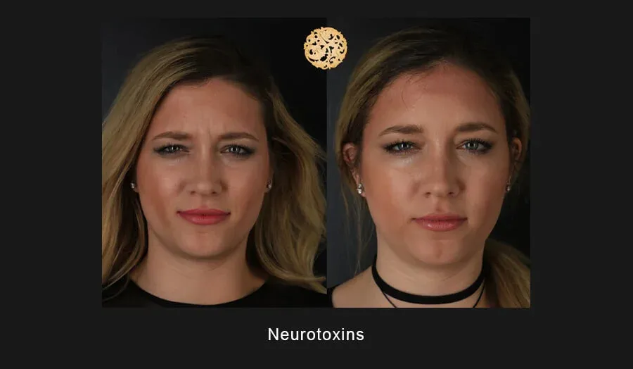 Neurotoxins Before & After