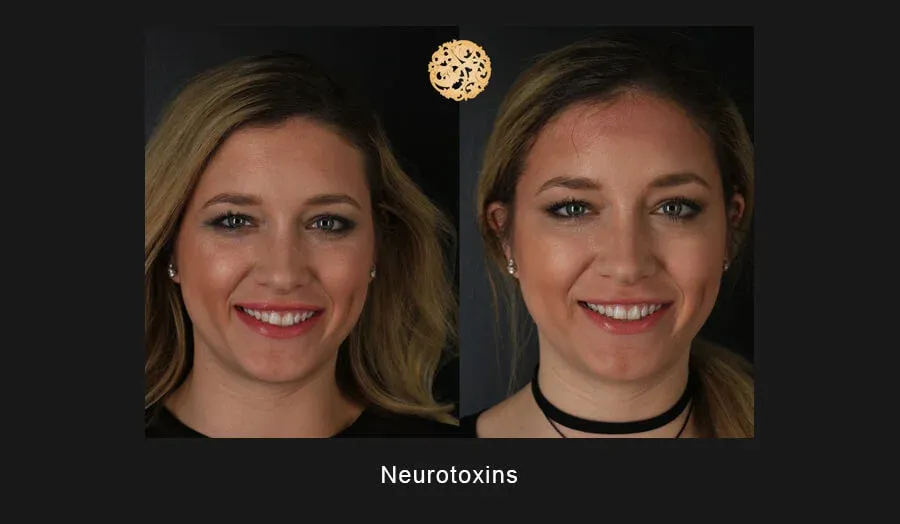 Neurotoxins Before & After