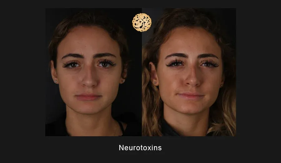 Neurotoxins Before & After