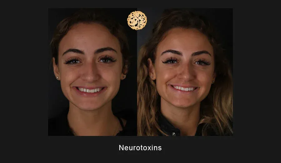 Neurotoxins Before & After
