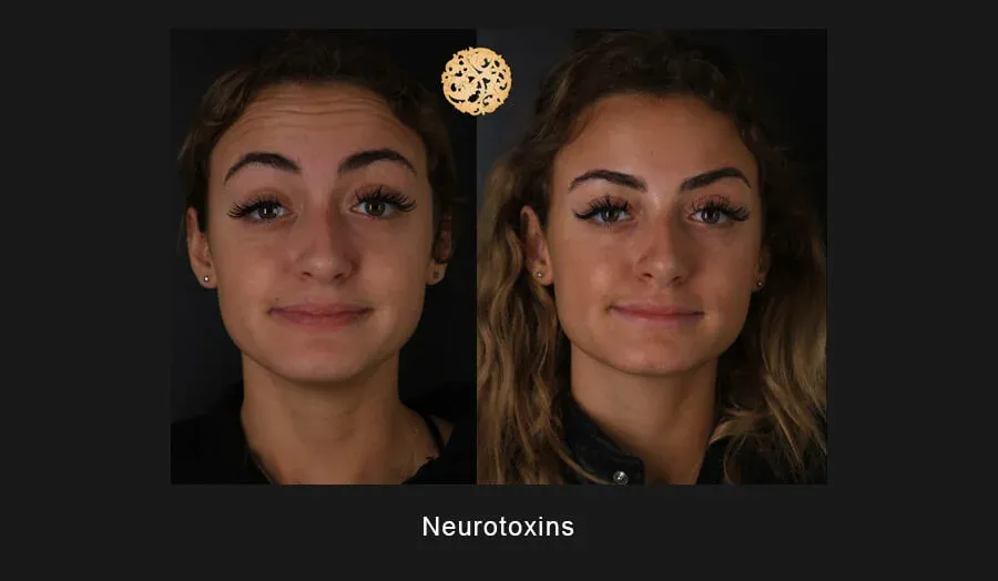 Neurotoxins Before & After