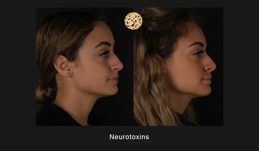 Neurotoxins Before & After