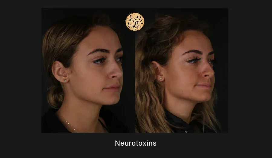 Neurotoxins Before & After