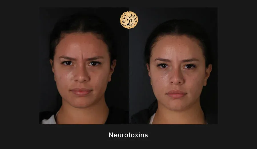 Neurotoxins Before & After