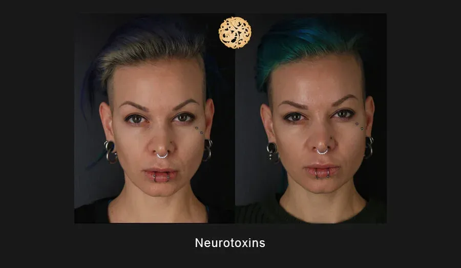 Neurotoxins Before & After