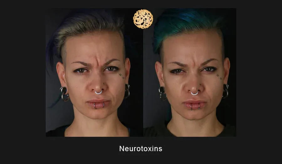 Neurotoxins Before & After