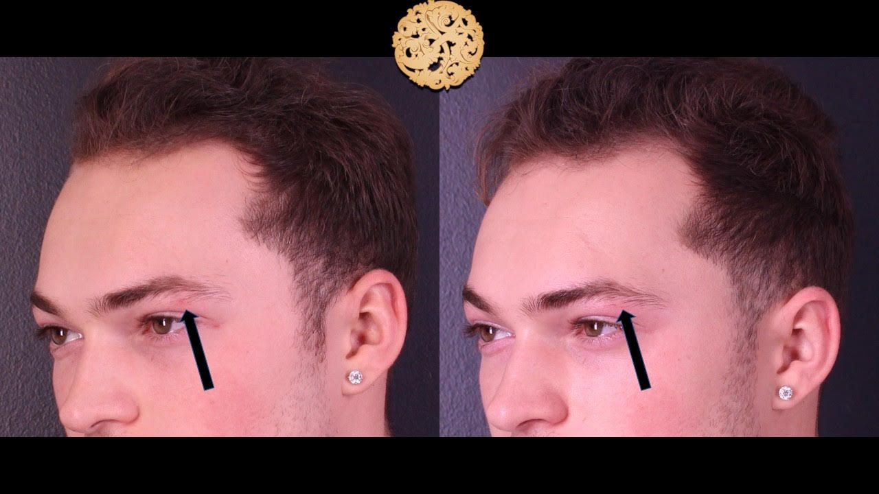 Genesis Before & After